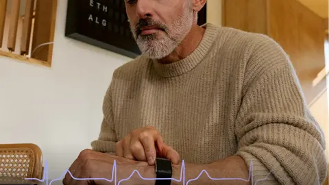 Whoop MG: Brilliant Health Insights Trapped Behind a Punishing Subscription