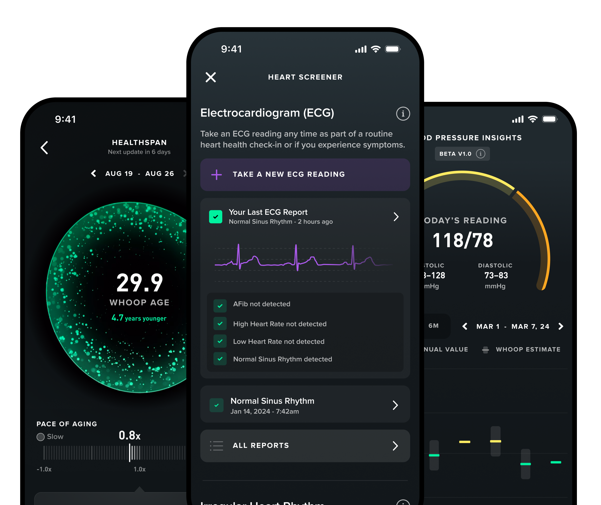 Whoop MG app showing ECG, Healthspan, and Blood Pressure features